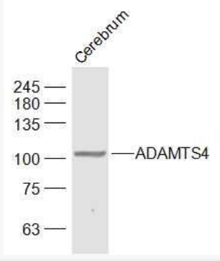 Anti-ADAMTS4 antibody-ADAMTS4抗体