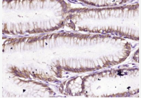 Anti-TCHP antibody-抑癌蛋白TCHP抗体