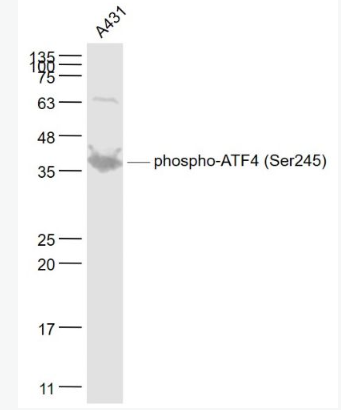 Anti-phospho-ATF4 (Ser245) antibody-磷酸化活化转录因子4抗体