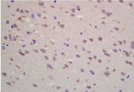 Anti-ADORA1  antibody-腺苷A1A受体抗体