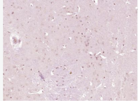 Anti-BMPR2 antibody-骨形态发生蛋白2受体抗体