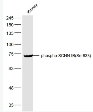 Anti-phospho-SCNN1B (Ser633) antibody-磷酸化上皮钠通β抗体