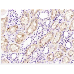 Anti-Cystatin C antibody-胱抑素C/半胱氨酸蛋白酶抑制剂C抗体