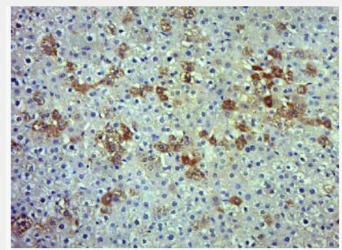 Anti-phospho-ADRB2 (Ser346) antibody-磷酸化肾上腺素能受体β2抗体