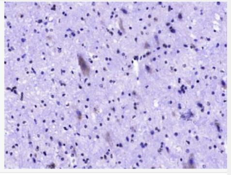 Anti-Phospho-c-Kit (Tyr721) antibody-磷酸化原癌基因蛋白c-kit（CD117）抗体