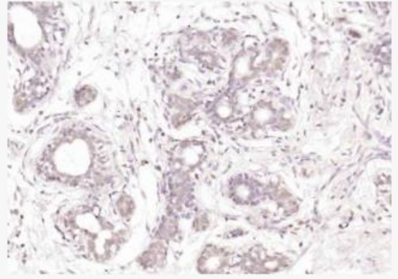 Anti-STAT5b antibody-信号转导和转录激活因子5b抗体