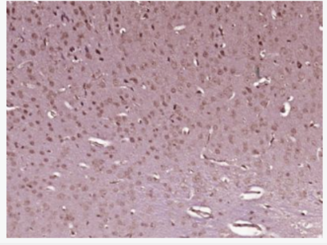 Anti-SRC3 antibody-丝氨酸/苏氨酸蛋白激酶ATR抗体