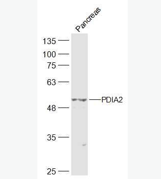 Anti-PDIA2  antibody-蛋白质二硫键异构酶抗体