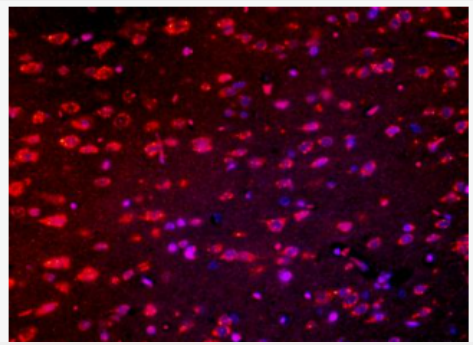 Anti-Robo antibody-轴突导向受体抗体