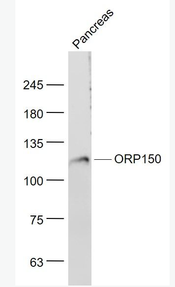 Anti-ORP150 antibody-氧气调节蛋白150抗体