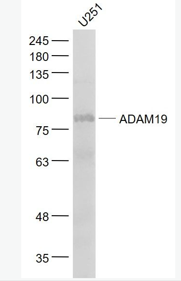 Anti-ADAM19 antibody-去整合素样金属蛋白酶19抗体