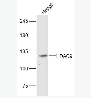 Anti-HDAC9 antibody-组蛋白去乙酰化酶9抗体