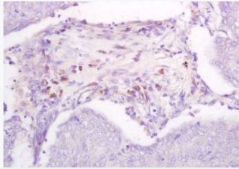 Anti-DBC2 antibody-乳腺癌基因删除蛋白2抗体