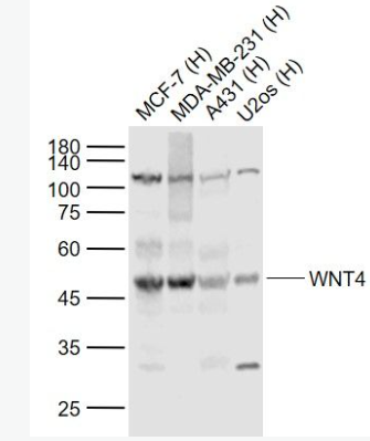 Anti-WNT4 antibody-信号通路Wnt4抗体