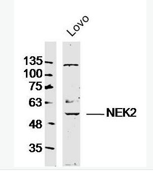 Anti-NEK2 antibody-中心体相关蛋白激酶Nek2抗体