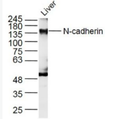 Anti-N-cadherin antibody-N-钙粘附分子抗体.