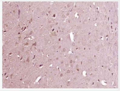 Anti-CXCL13/BCA1 antibody-B-淋巴细胞趋化因子抗体