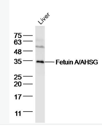 Anti-Fetuin A/AHSG antibody-胎球蛋白A