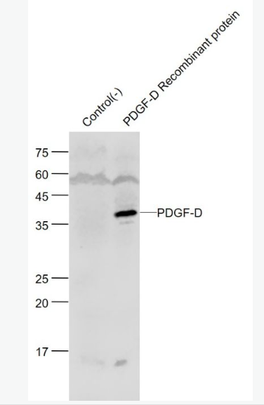 Anti-PDGF-D/SCDGFB antibody-血小板源性生长因子D/脊髓源性生长因子B抗体