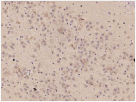 Anti-TNFAIP5 antibody-肿瘤坏死因子α诱导蛋白5抗体