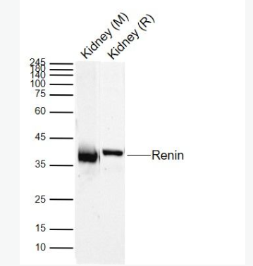 Anti-Renin antibody-肾素/血管紧张素形成酶Ren1抗体