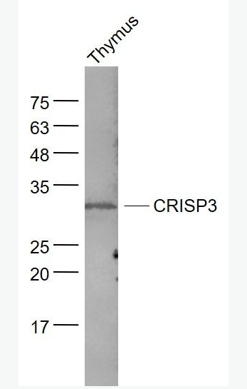 Anti-CRISP3 antibody-富含半胱氨酸分泌蛋白3抗体