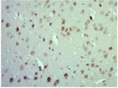 Anti-MARK4 antibody-丝氨酸/苏氨酸蛋白激酶MARK4抗体