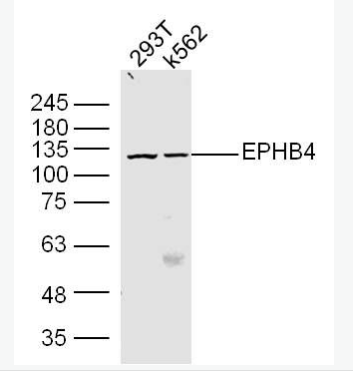 Anti-EPHB4  antibody-酪氨酸蛋白激酶受体B4抗体