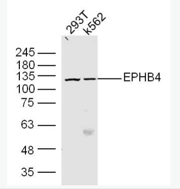Anti-ENPP2 antibody-核苷酸焦磷酸酶2抗体