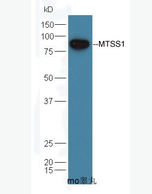 Anti-MTSS1 antibody-肿瘤转移抑制蛋白1