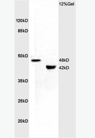 Anti-KCNN4 antibody-钙激活钾通道蛋白4抗体