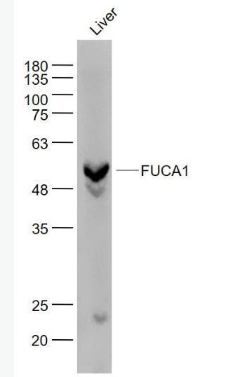 Anti-FUCA1  antibody-α-L岩藻糖苷酶抗体