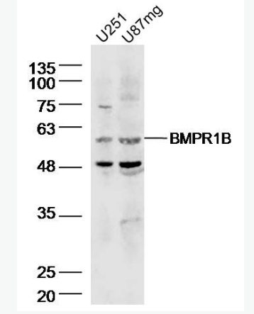 Anti-BMPR1B antibody-骨形态发生蛋白受体1B抗体