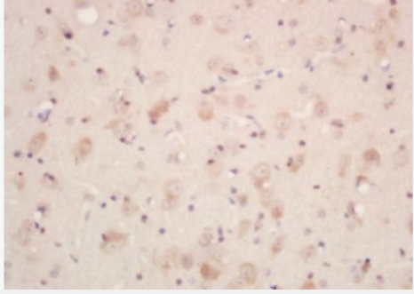 Anti-Neurotensin antibody-神经紧张素抗体