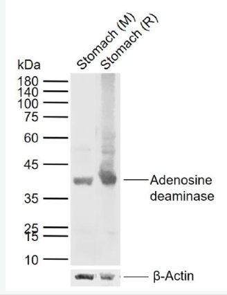 Anti-Adenosine deaminase antibody-腺苷脱氨酶(ADA)抗体