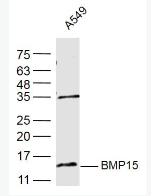 Anti-BMP15 antibody-骨形态发生蛋白15抗体