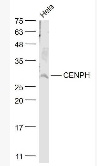 Anti-CENPH antibody-着丝粒蛋白H抗体