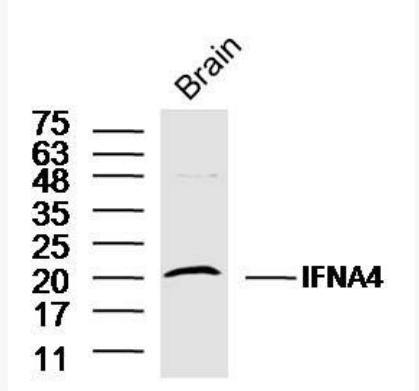 Anti-IFNA4 antibody-干扰素α4抗体.