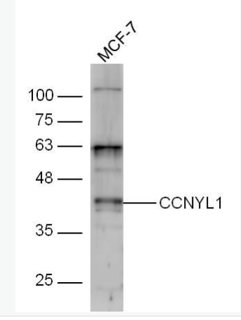 Anti-CCNYL1 antibody-周期素样Y1抗体