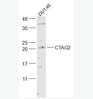 Anti-CTAG2 antibody-肿瘤/睾丸抗原2抗体