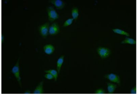 Anti-DICER1 antibody-核糖核酸酶Dicer抗体