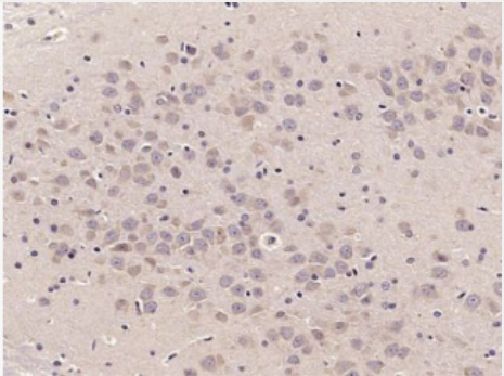 Anti-NEK1 antibody-丝氨酸/苏氨酸蛋白激酶NEK1抗体