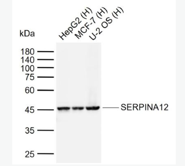 Anti-SERPINA12 antibody-内脏脂肪组织源性丝氨酸蛋白酶抑制蛋白抗体