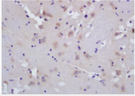 Anti-ALOX5AP antibody-5脂氧合酶激活蛋白抗体