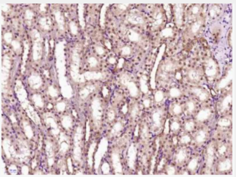 Anti-GCMA antibody-绒毛膜特异性转录因子GCMa抗体