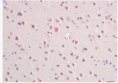 Anti-IFNAR2 antibody-干扰素α受体2抗体