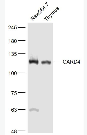 Anti-CARD4 antibody-凋亡加强结构域蛋白4抗体