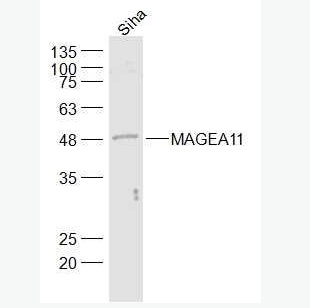 Anti-MAGEA11 antibody-黑色素瘤相关抗原11抗体