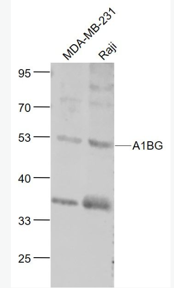 Anti-A1BG antibody-α1B糖蛋白抗体