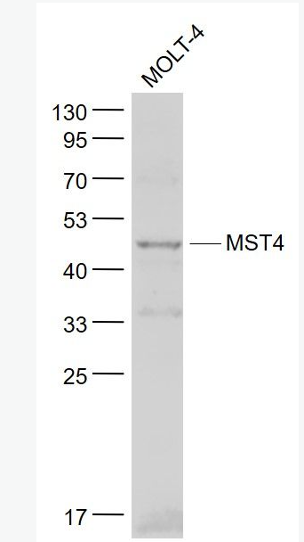 Anti-MST4 antibody-丝氨酸/苏氨酸蛋白激酶MST4抗体